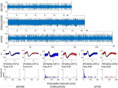 Low Frequency Microstimulation Is Locally Excitatory in Patients With Epilepsy